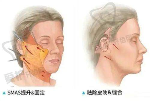 本溪元辰医疗美容诊所预约方式