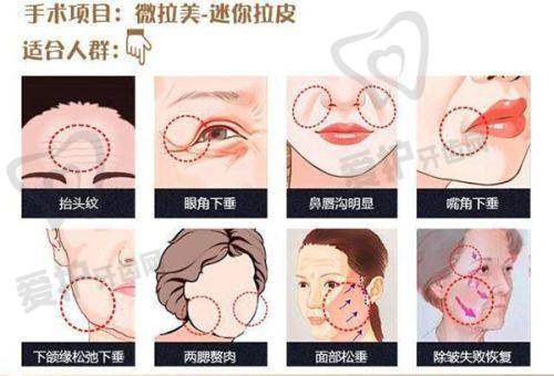 4. 肿胀和疼痛