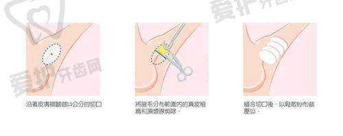 张朋医生详细介绍