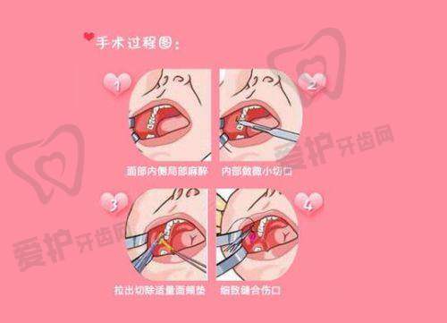 患者真实口碑评价