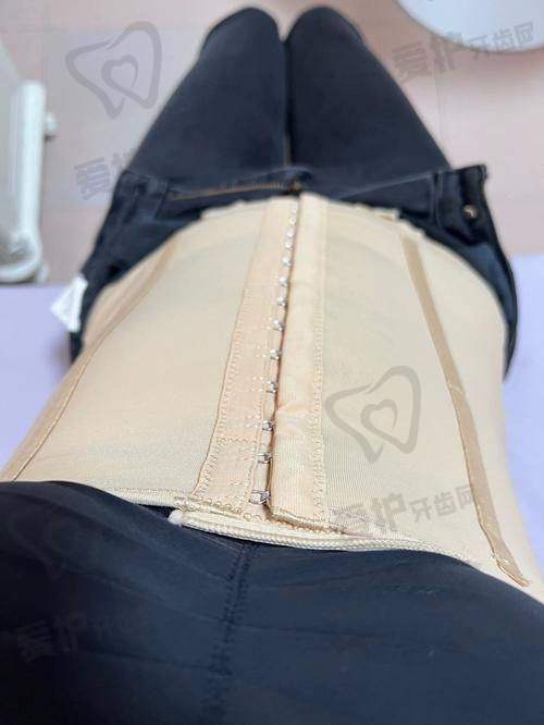上海华美医疗美容医院张朋分层紧肤吸脂项目价格解析