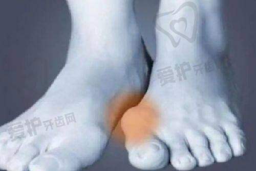 在实际实例中,玻尿酸和胶原蛋白填充有哪些不同的表现?