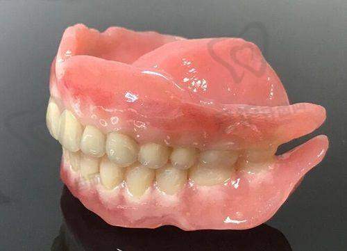 江门壹心维美口腔做瑞典Astra种植牙的具体优势