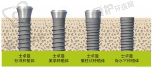 正畸什么阶段打骨钉呢？