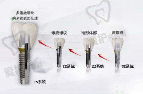 新医生接手中途转诊的正畸患者后会怎么做？