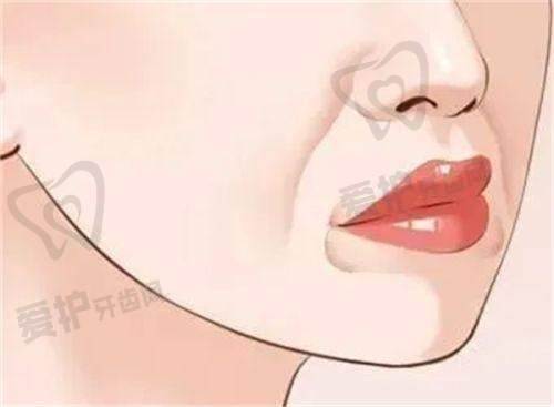 美杜莎双眼皮实例多吗，和普通双眼皮实例数量有差异吗？