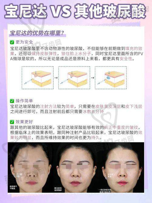 美容线吸收过程中需要注意什么?