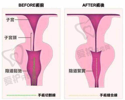 医院/医生做濡白天使玻尿酸项目的具体优势