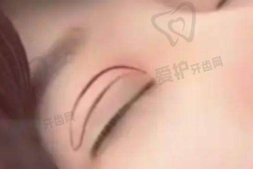 王占福医生怎么预约挂号