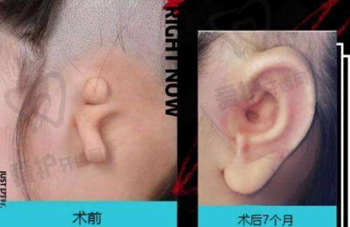 刘凯医生怎么预约挂号