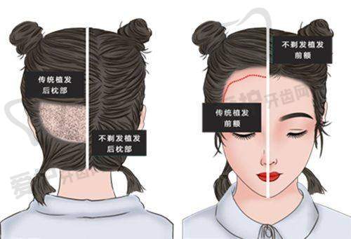 刘誉医生擅长项目