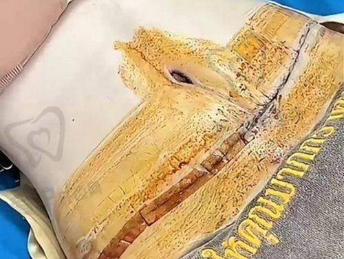 胡海潮医生怎么预约挂号