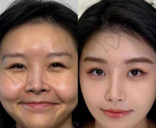 宋跃医生擅长项目
