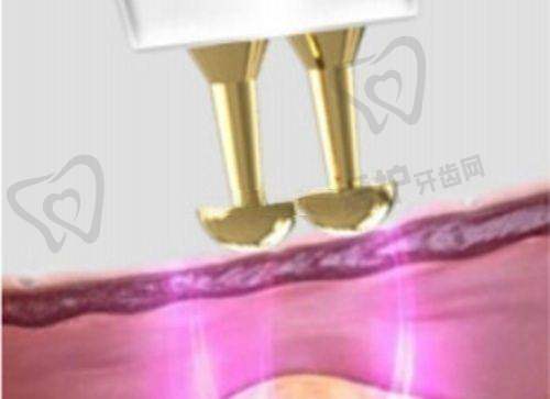 王洪宇医生怎么预约挂号