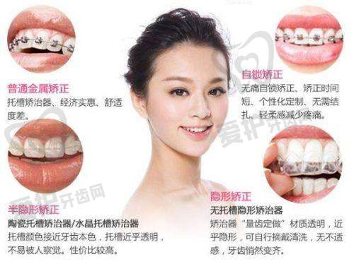 重庆荣昌杨明春口腔门诊部预约方式