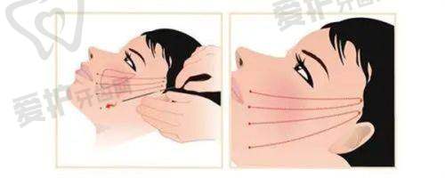 刘凯医生擅长项目