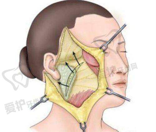 管连斌医生怎么预约挂号