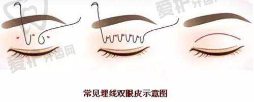 徐云泳医生怎么预约挂号