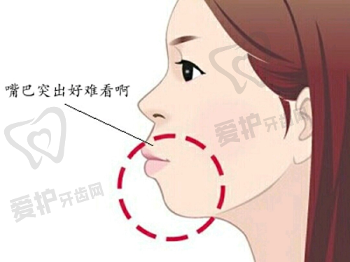 画缇轮廓针的作用机理是什么