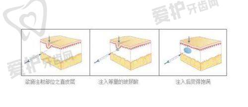 宋跃医生怎么预约挂号