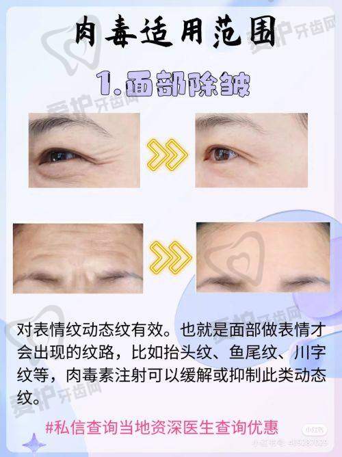 杨庆峰医生怎么预约挂号
