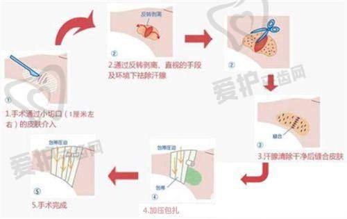 于德印医生技术特色