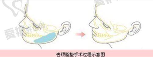 王占福医生真实的患者口碑评价