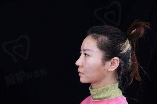 北京画美医疗美容医院做这一项目的具体优势