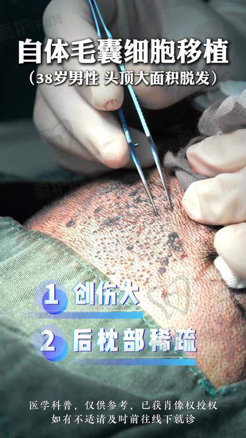 王兵医生擅长项目