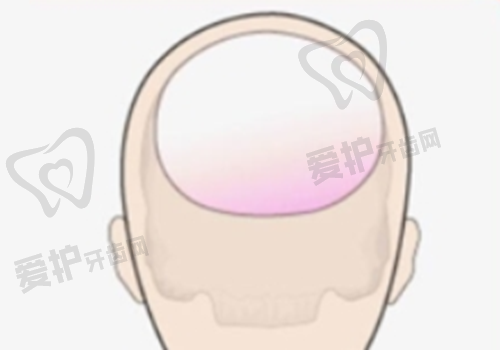 医院做欧洲之星全方面部项目的具体优势