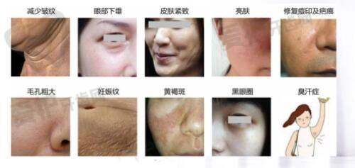 湛江韩美整形医院:项目价格详情