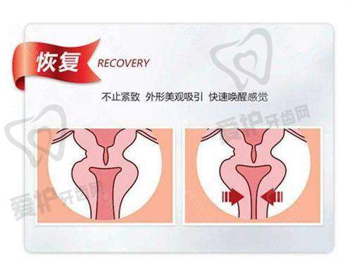广州荔湾区 - 奥美定取出