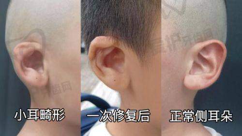 大连沙医生整形医院医生的“好”体现在哪？