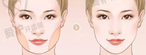 北京嘉禾医疗美容医院侯智慧手术阴道紧缩+私密修复+蒂包敏感提升 18750 元起，微创恢复快还能提升性质量！