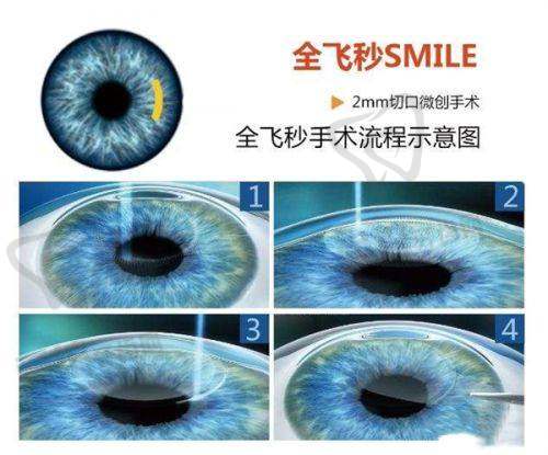 (五)河源光明眼科医院现场预约(即到即办)