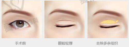 北京润颜医疗美容诊所正规吗