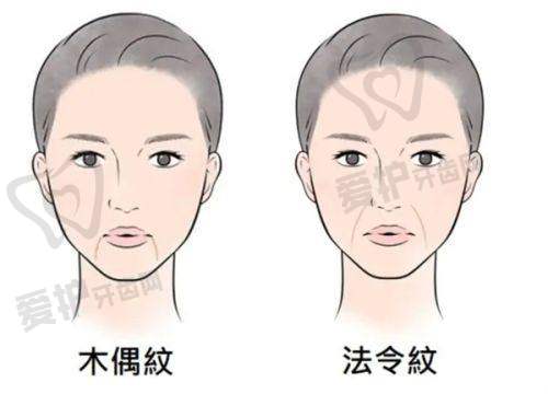 25年深圳鹏程医院疤痕科注射淡疤价格