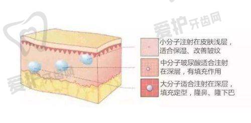 武汉华美：具备开展面部大拉皮手术的资质与优势