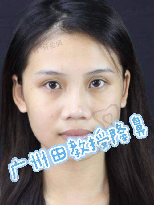 白继平医生做这一项目的具体优势