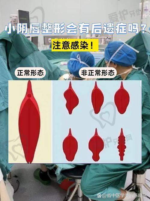 太原军大做阴道紧缩术的优势
