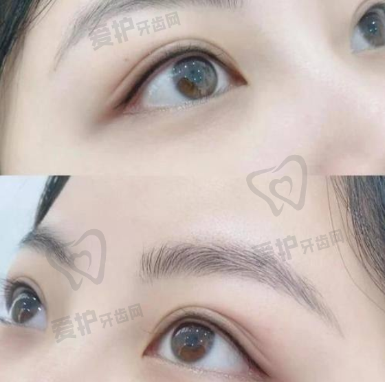 25年深圳鹏程医院疤痕科激光净肤价格