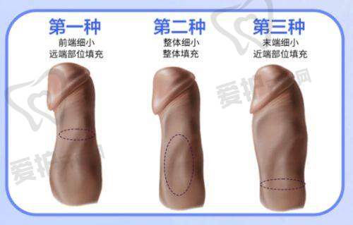 边志超医生怎么预约挂号