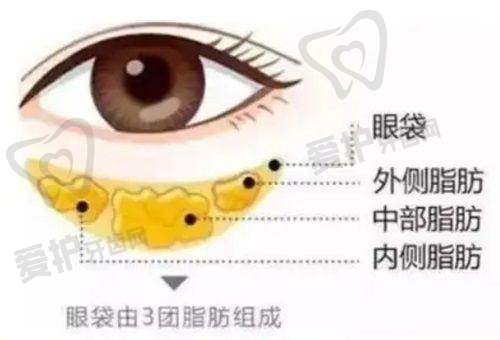 贵州利美康外科医院做外切祛眼袋项目的优势