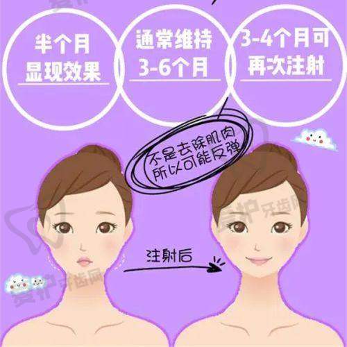 李在郁医生注射玻尿酸技术优势