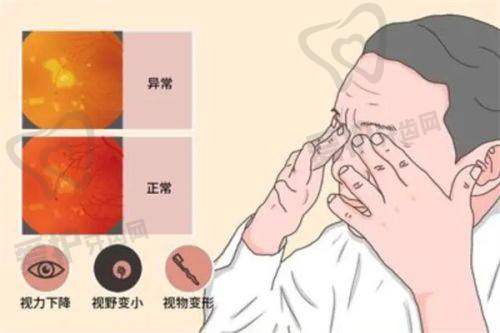 申请2025杭州60岁以上老人白内障免费手术政策过程中需要注意什么