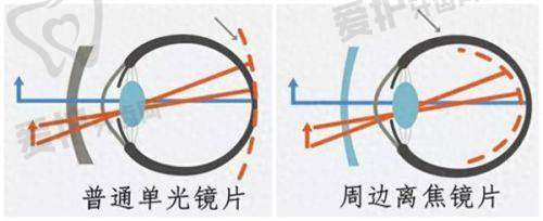 北京爱尔眼科医院正规吗