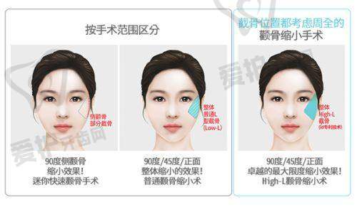 真人实例：五种典型需求的解决方案