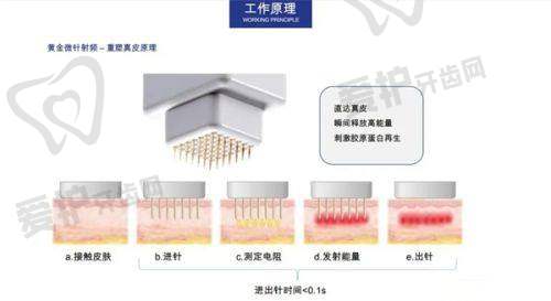 黄金微针项目价格解析医院简介
