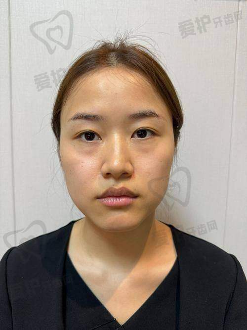 淮安华美秦红阳医生做这一项目的具体优势