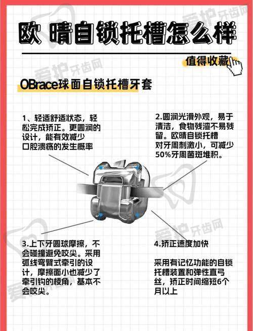 汕头奥诗卡口腔医院做球面金属矫正项目的具体优势